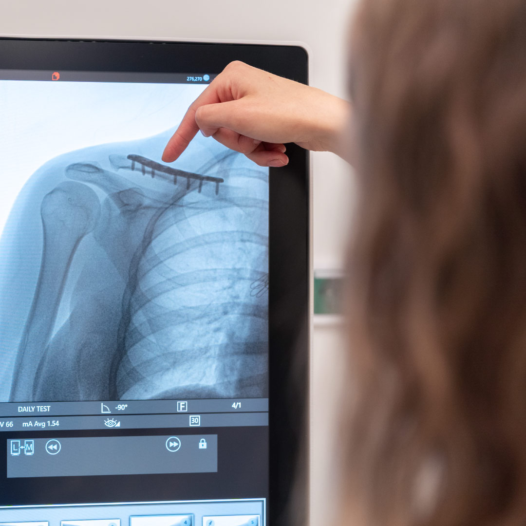 Kiirgusdoosi optimeerimine ja pildikvaliteet